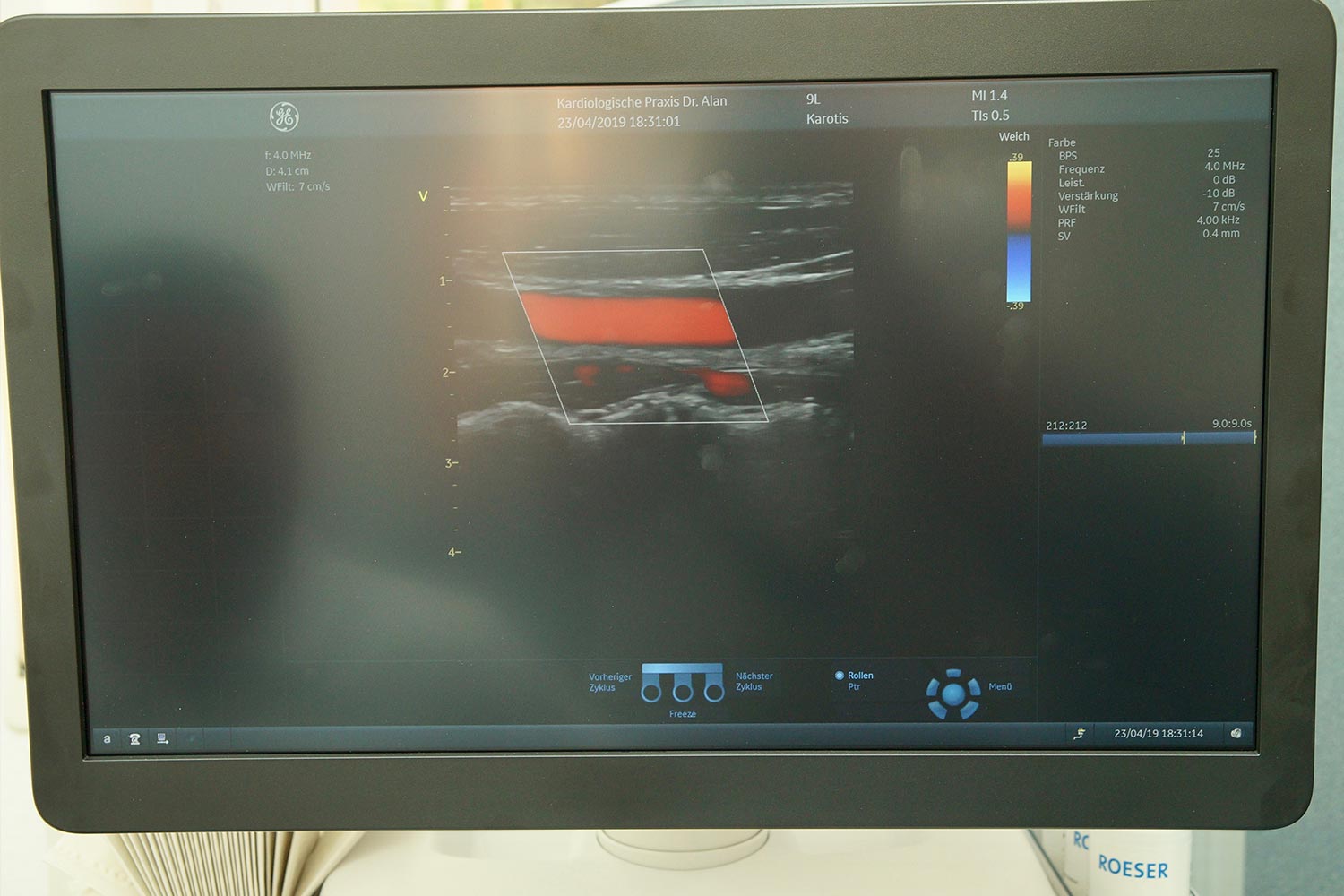 Ultraschalluntersuchung der Halsschlagadern | Kardiologie Laupheim Dr. Alan
